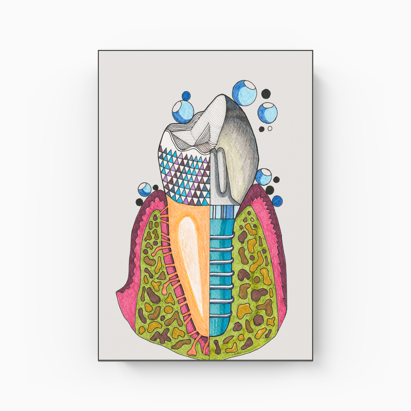 implant - Kanvas Tablo