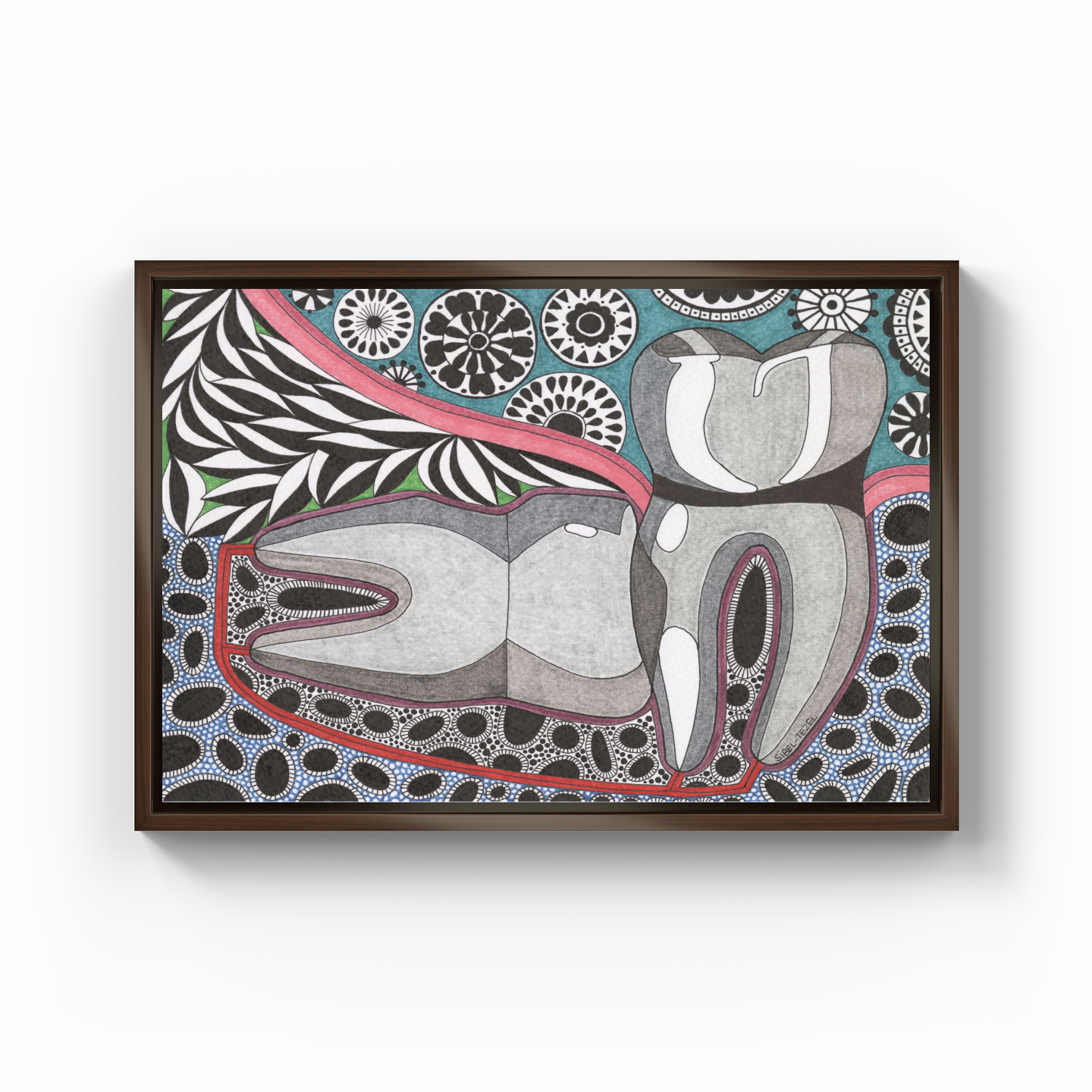 horizontal impact wisdom tooth - Canvas Print