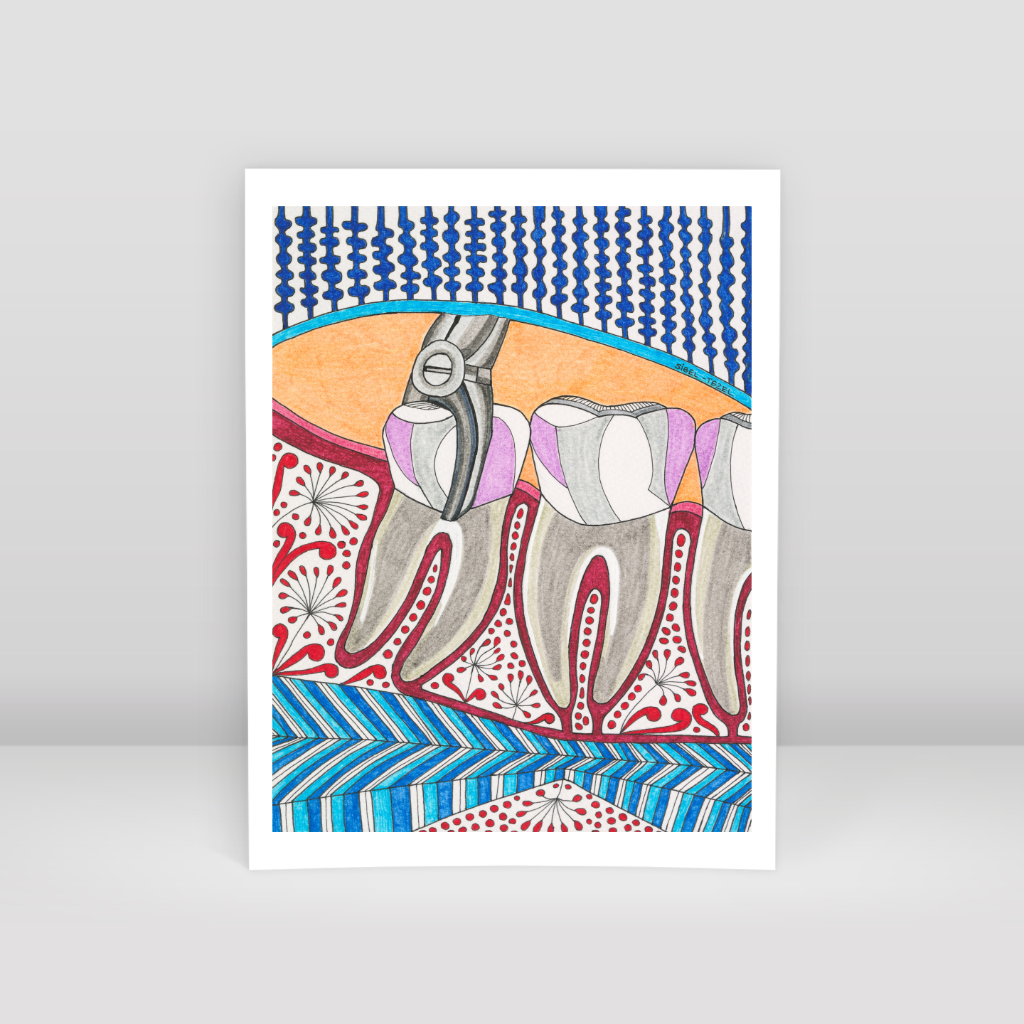 tooth extraction - Art Print