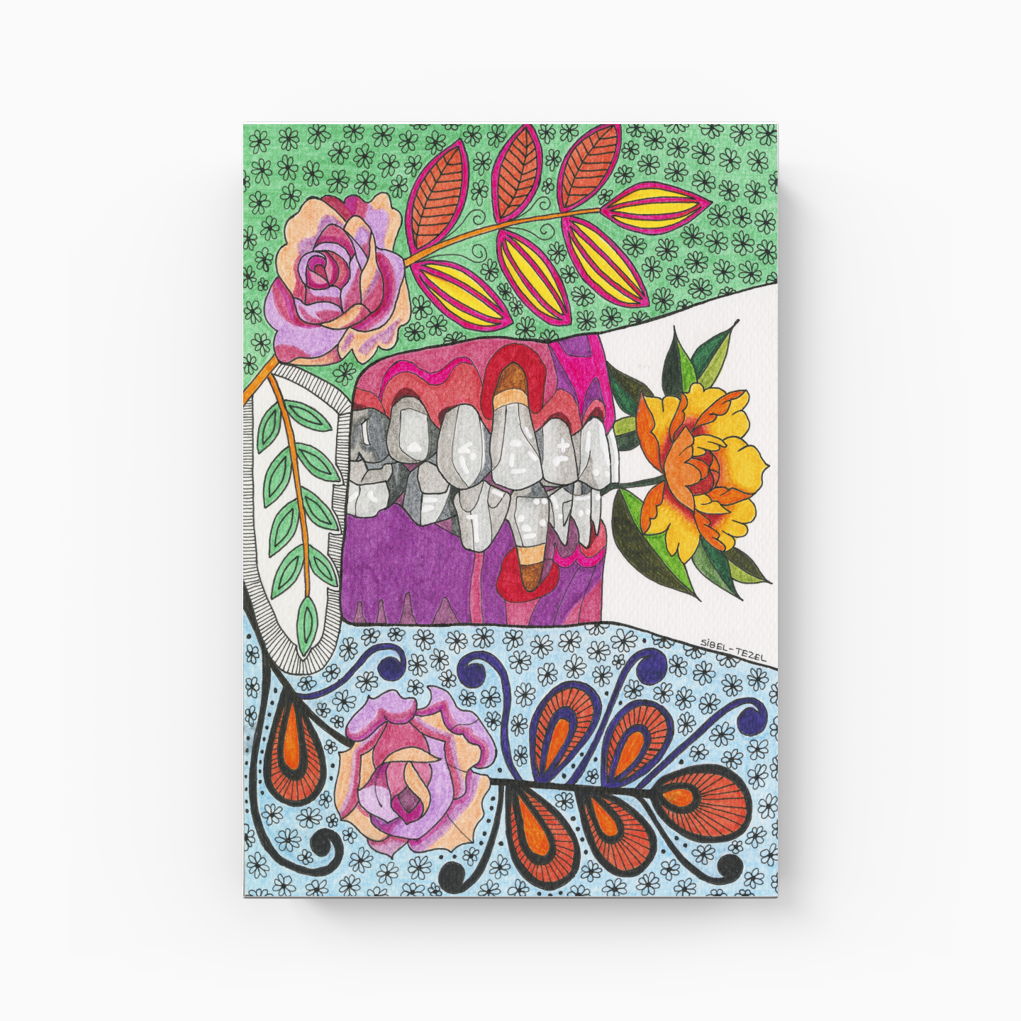 gingival recession1 - Canvas Painting