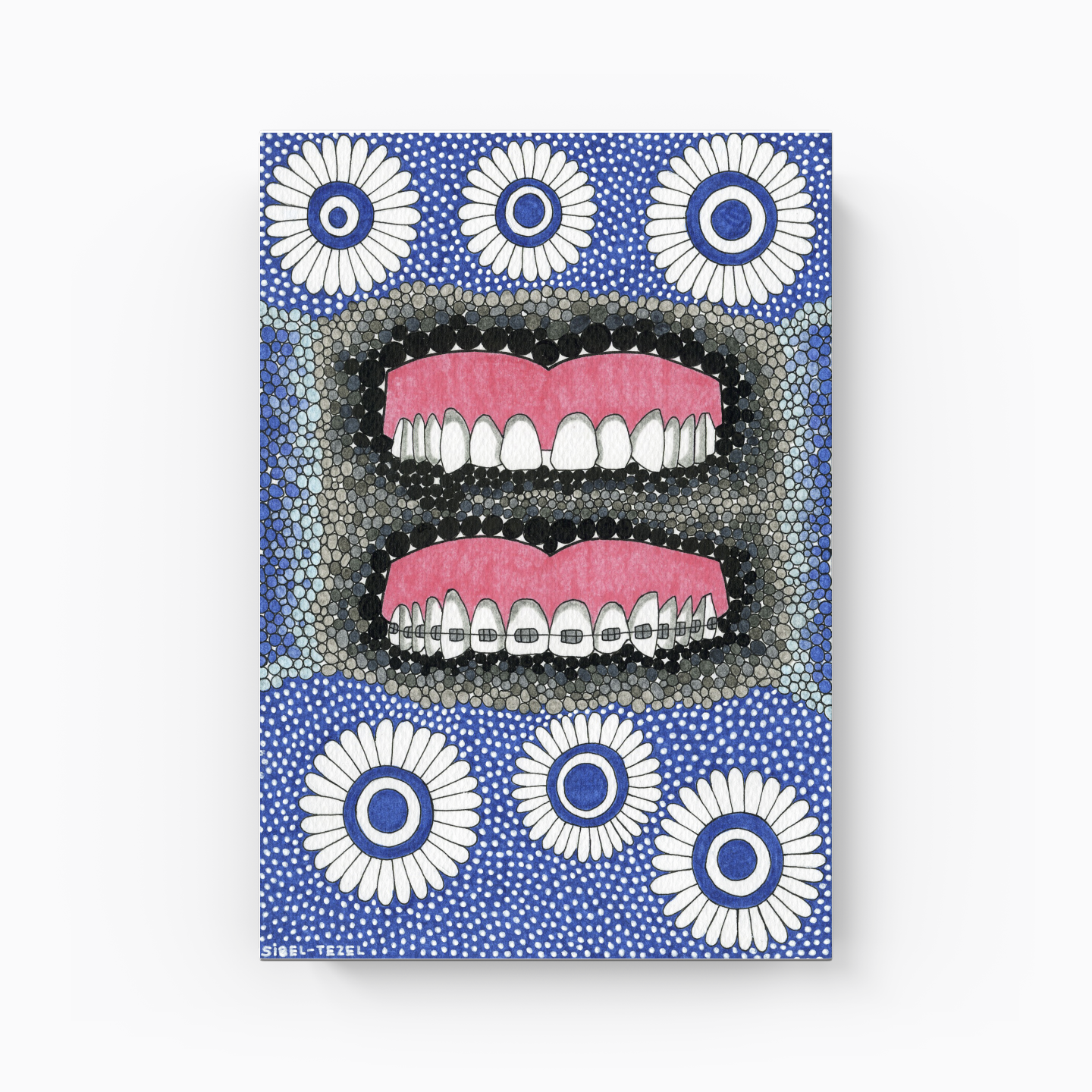 diastema and orthodontics - Canvas Print