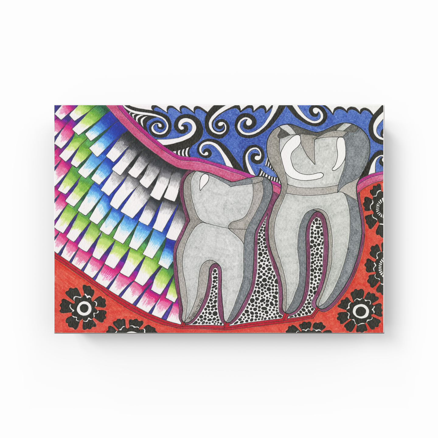 mesial impact wisdom tooth - Canvas Print