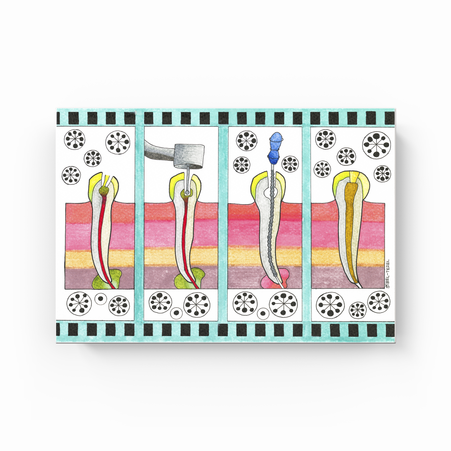 canal treatment - Canvas Print