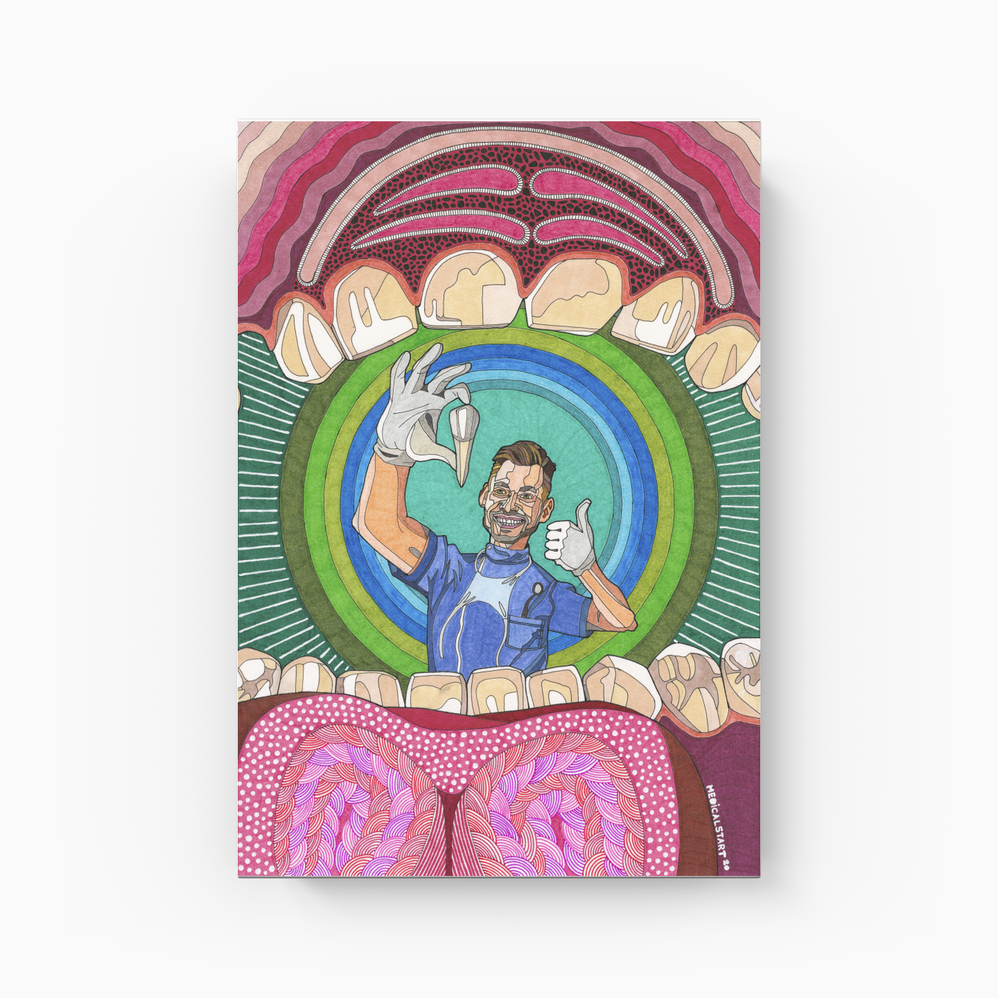 maximillar premolar tooth extraction - Kanvas Tablo