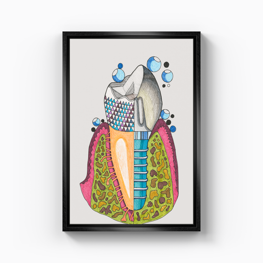 implant - Canvas Painting