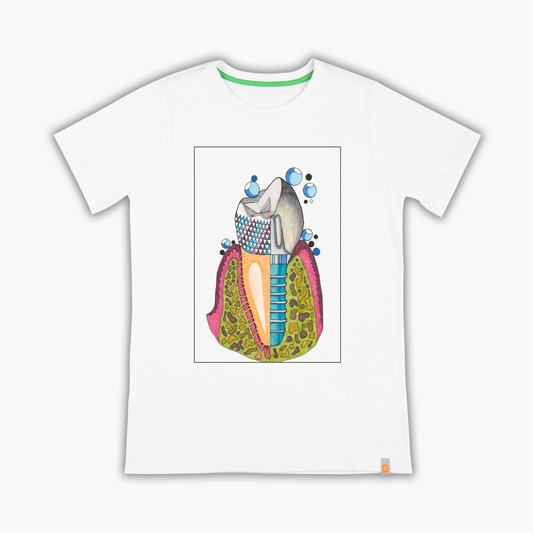 implant - T-shirt