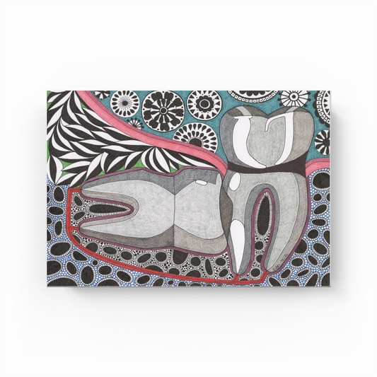 horizontal impact wisdom tooth - Canvas Print