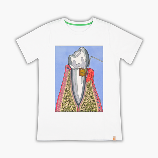 gingival recesión - T-shirt