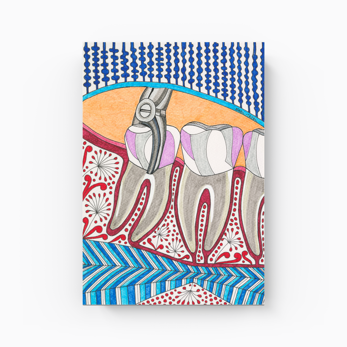 tooth extraction - Canvas Print