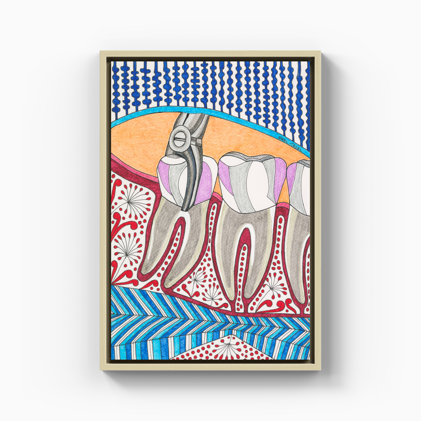 tooth extraction - Canvas Print