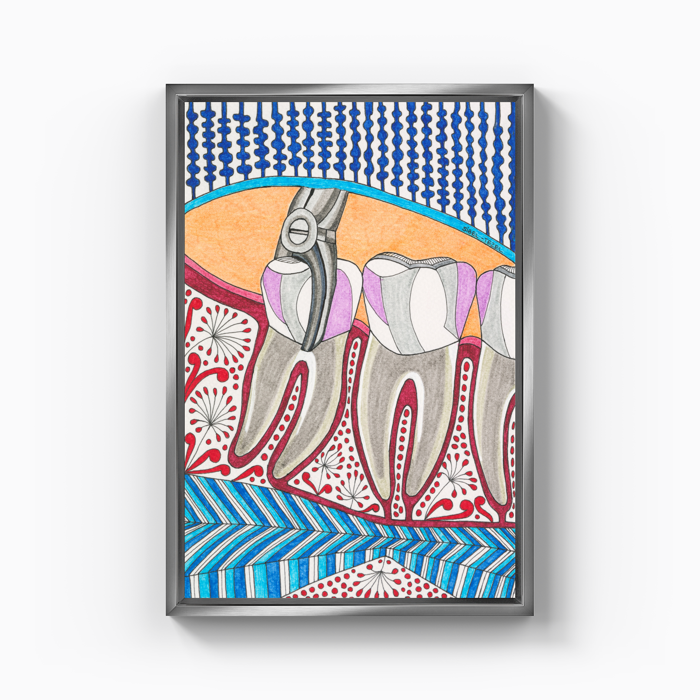 tooth extraction - Canvas Print