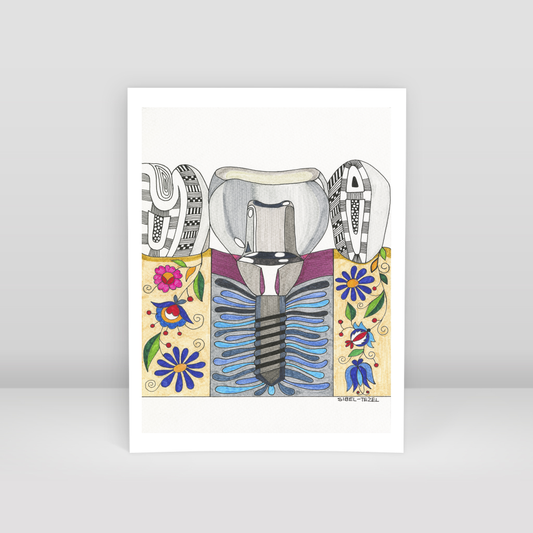implant1 - Art Print