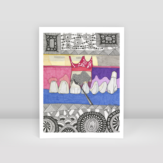 gingival surgery - Art Print