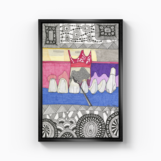 gingival surgery - Canvas Painting