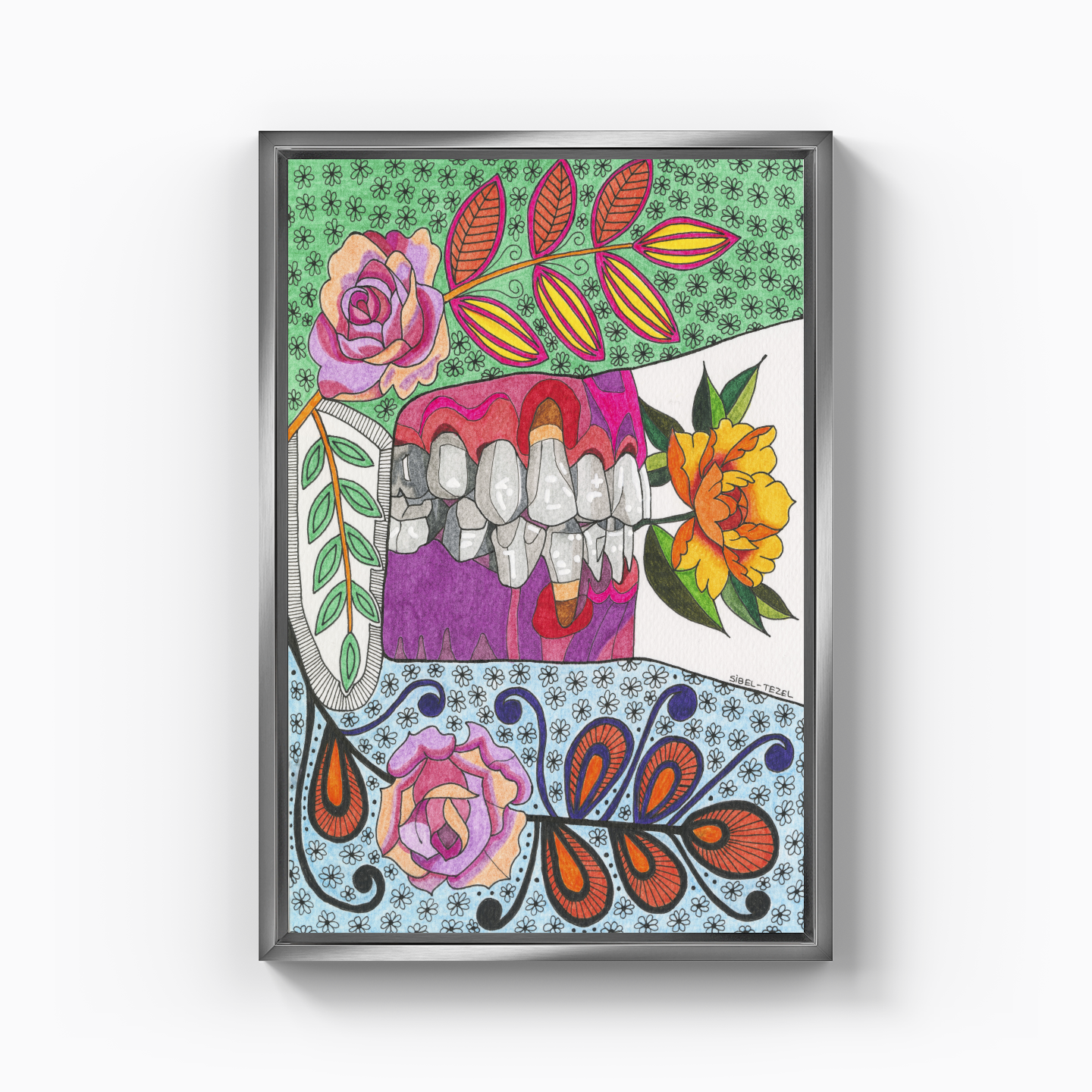 gingival recession1 - Canvas Painting