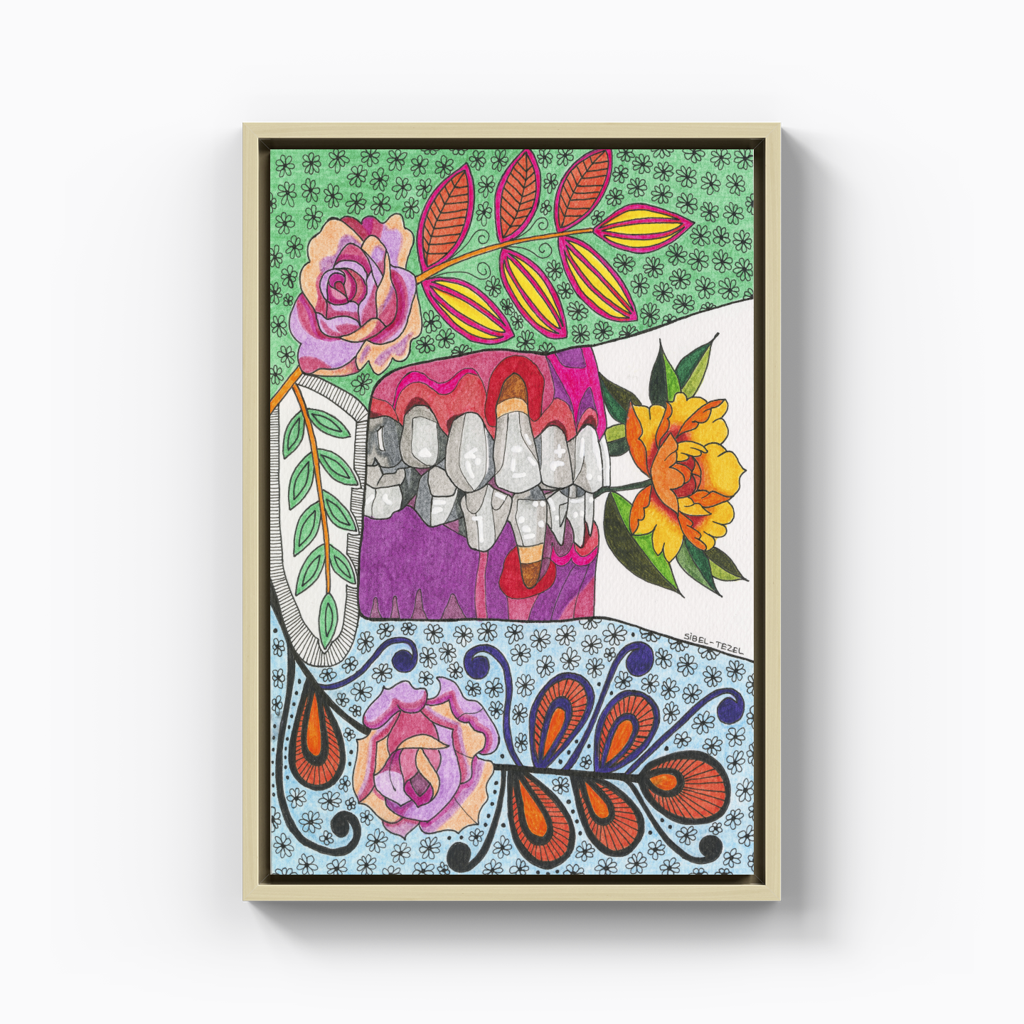 gingival recession1 - Canvas Painting