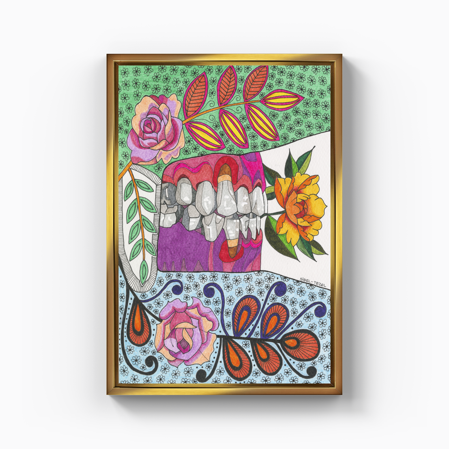 gingival recession1 - Canvas Painting