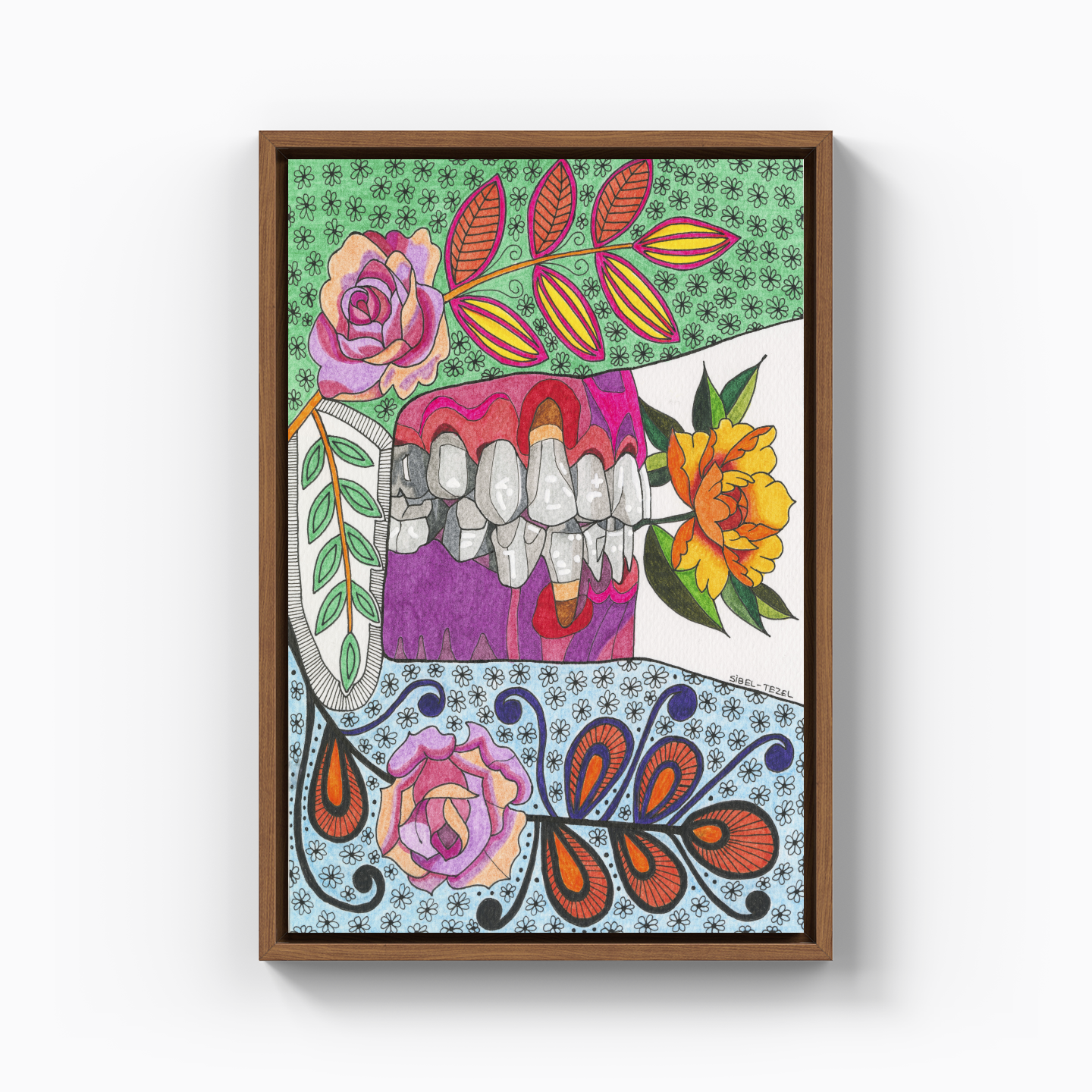 gingival recession1 - Canvas Painting
