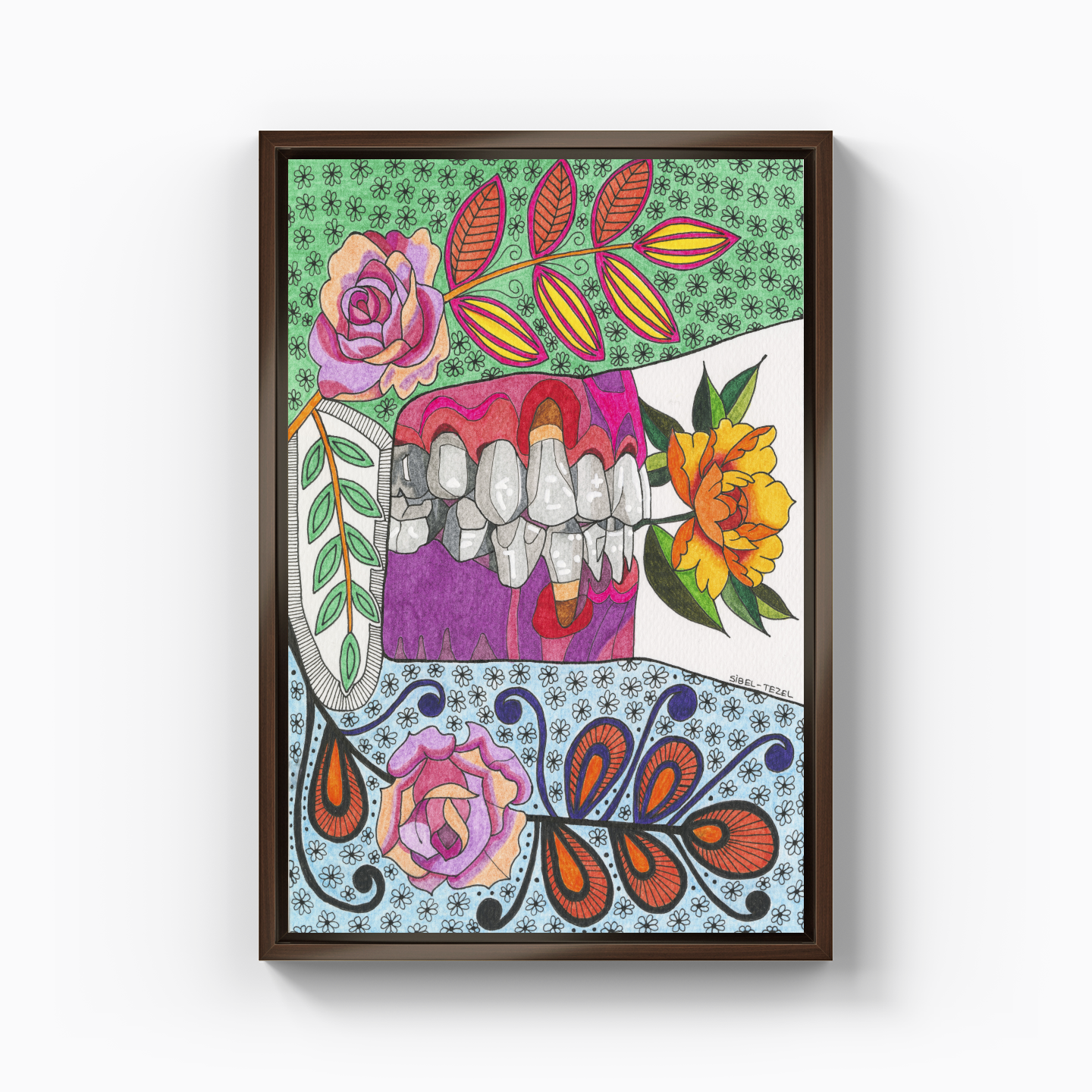 gingival recession1 - Canvas Painting