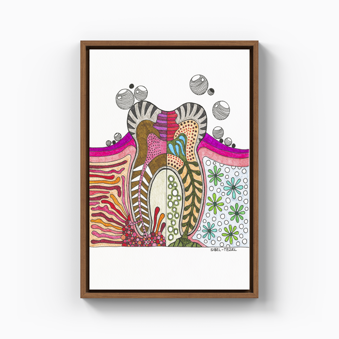 profound careers and abscess - Canvas Print