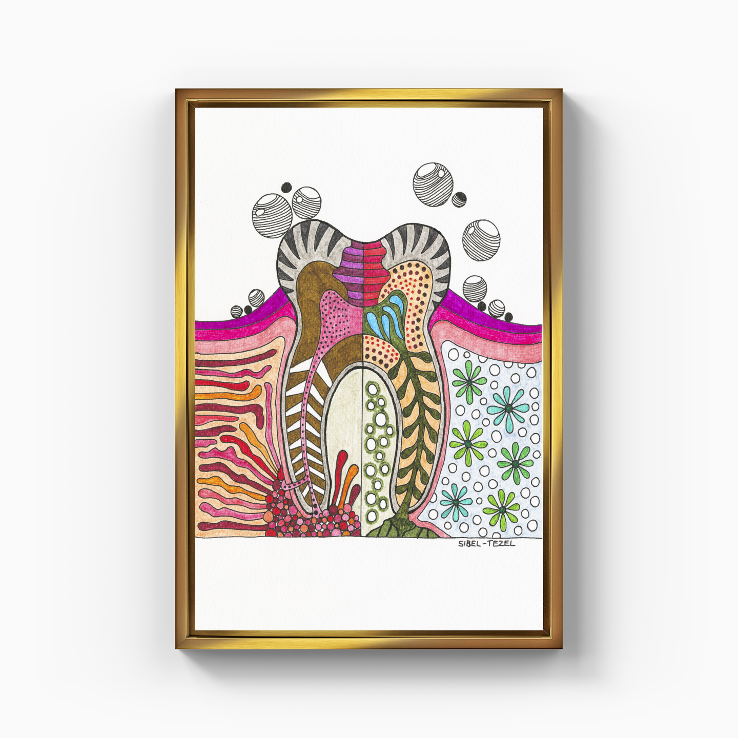 profound careers and abscess - Canvas Print