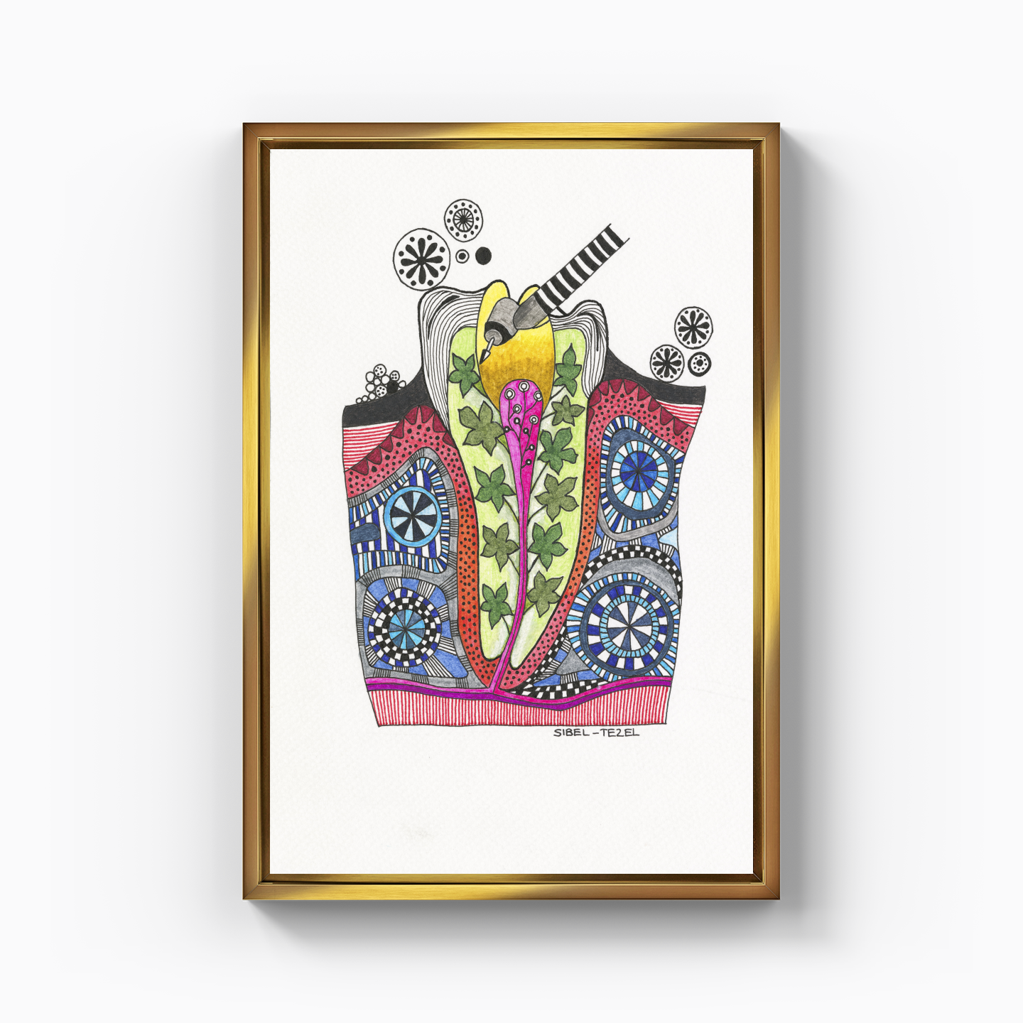 root canal treatment - Canvas Print