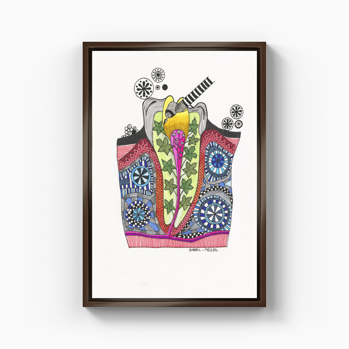 root canal treatment - Canvas Print
