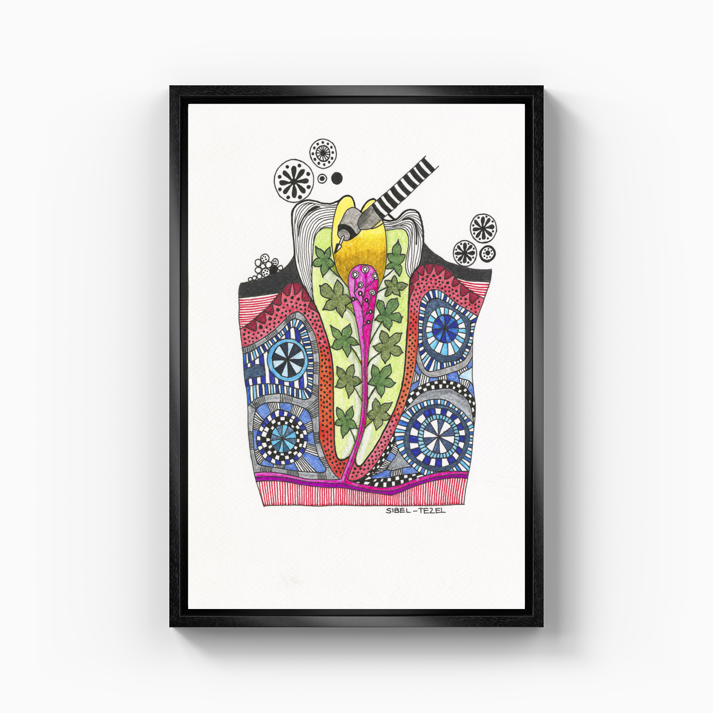 root canal treatment - Canvas Print