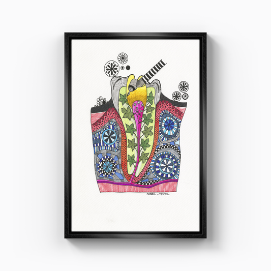 root canal treatment - Canvas Print