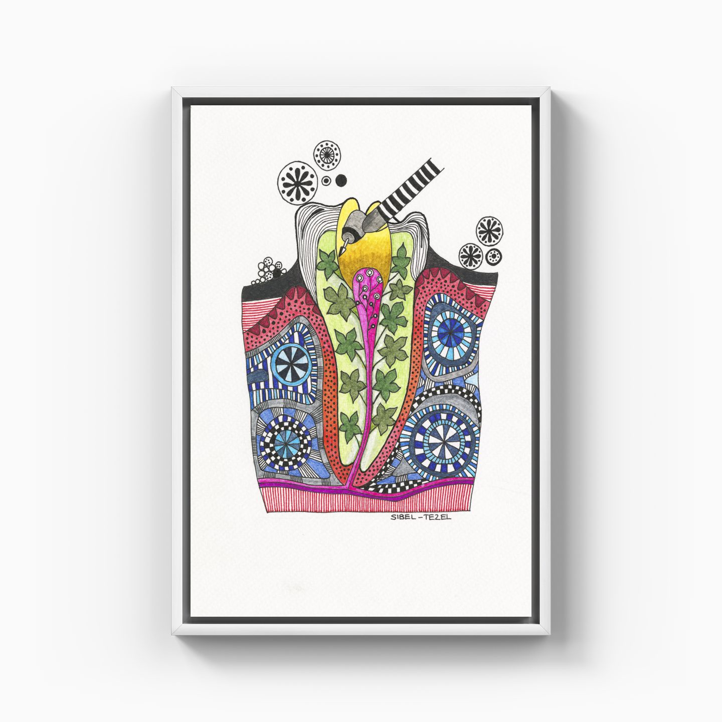 root canal treatment - Canvas Print