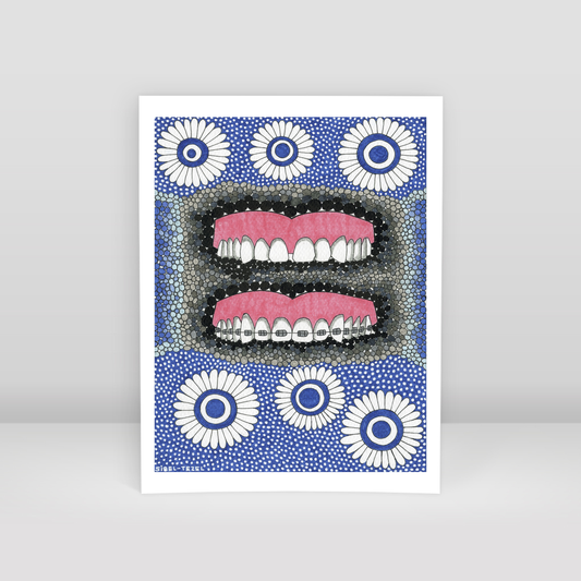 diastema and orthodontics - Art Print