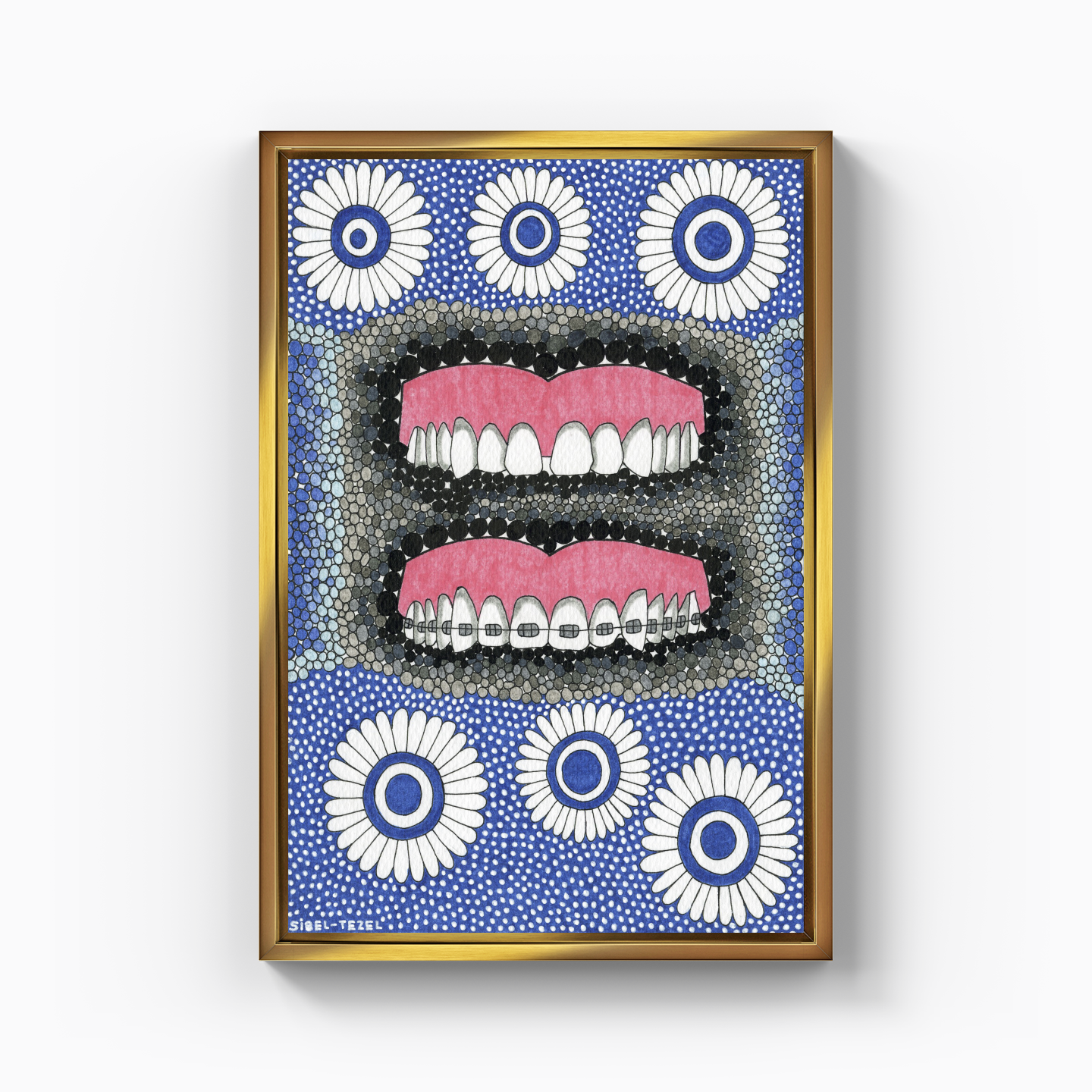 diastema and orthodontics - Canvas Print