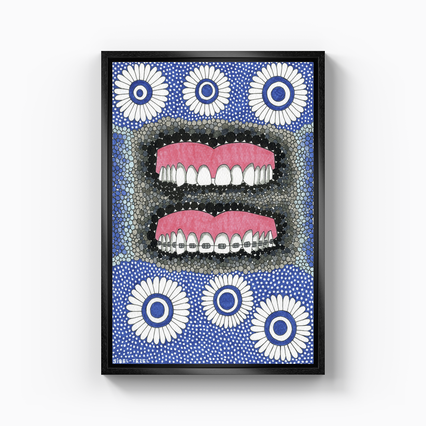 diastema and orthodontics - Canvas Print