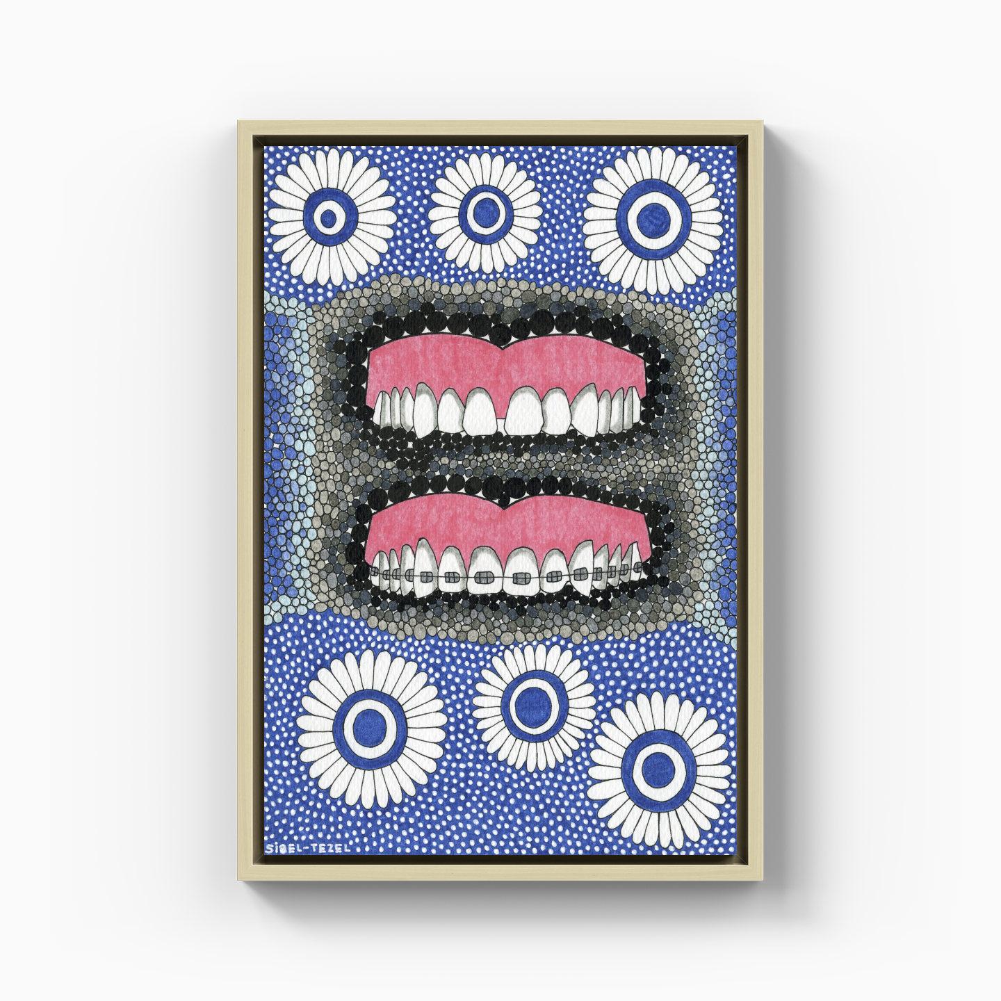 diastema and orthodontics - Canvas Print