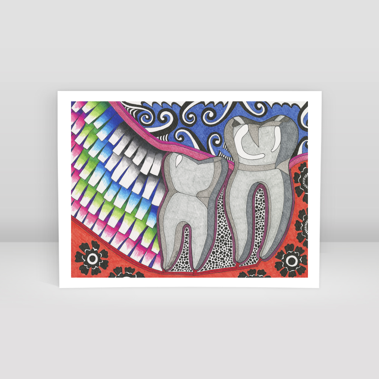 mesial impaction wisdom tooth - Art Print