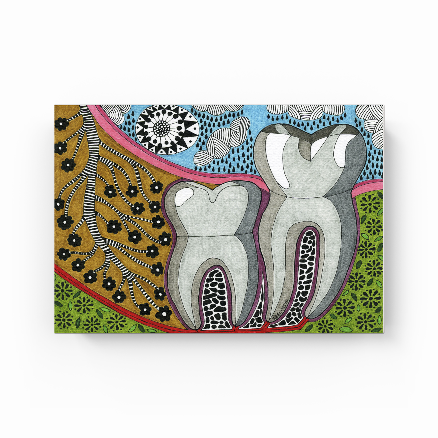vertical impaction wisdom tooth - Kanvas Tablo