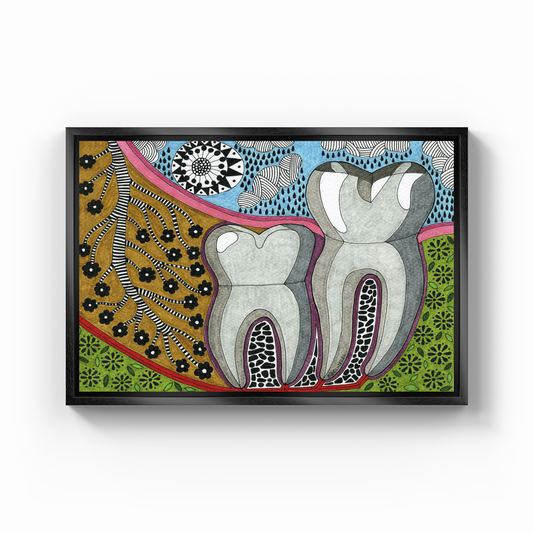 vertical impact wisdom tooth - Canvas Print
