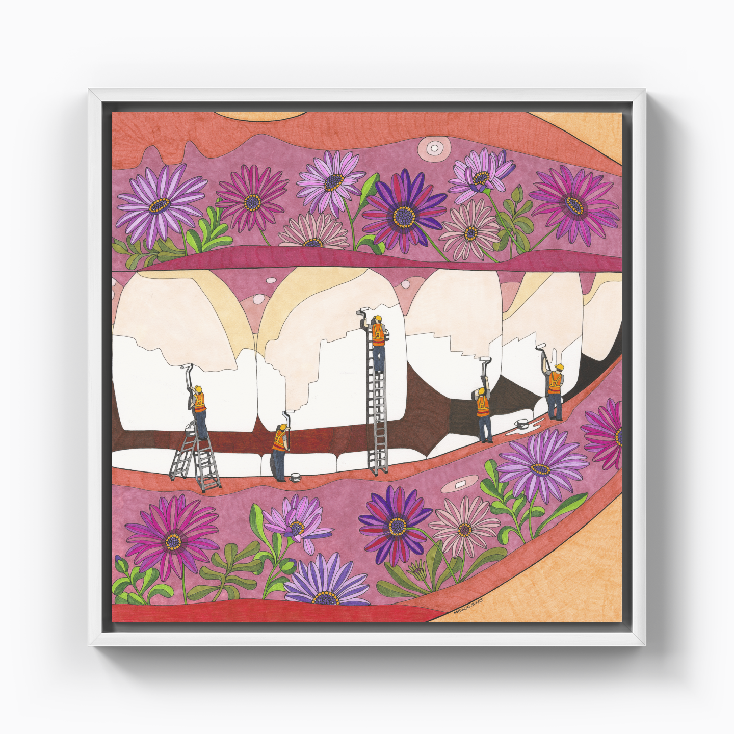 teeth whitening - Canvas Print