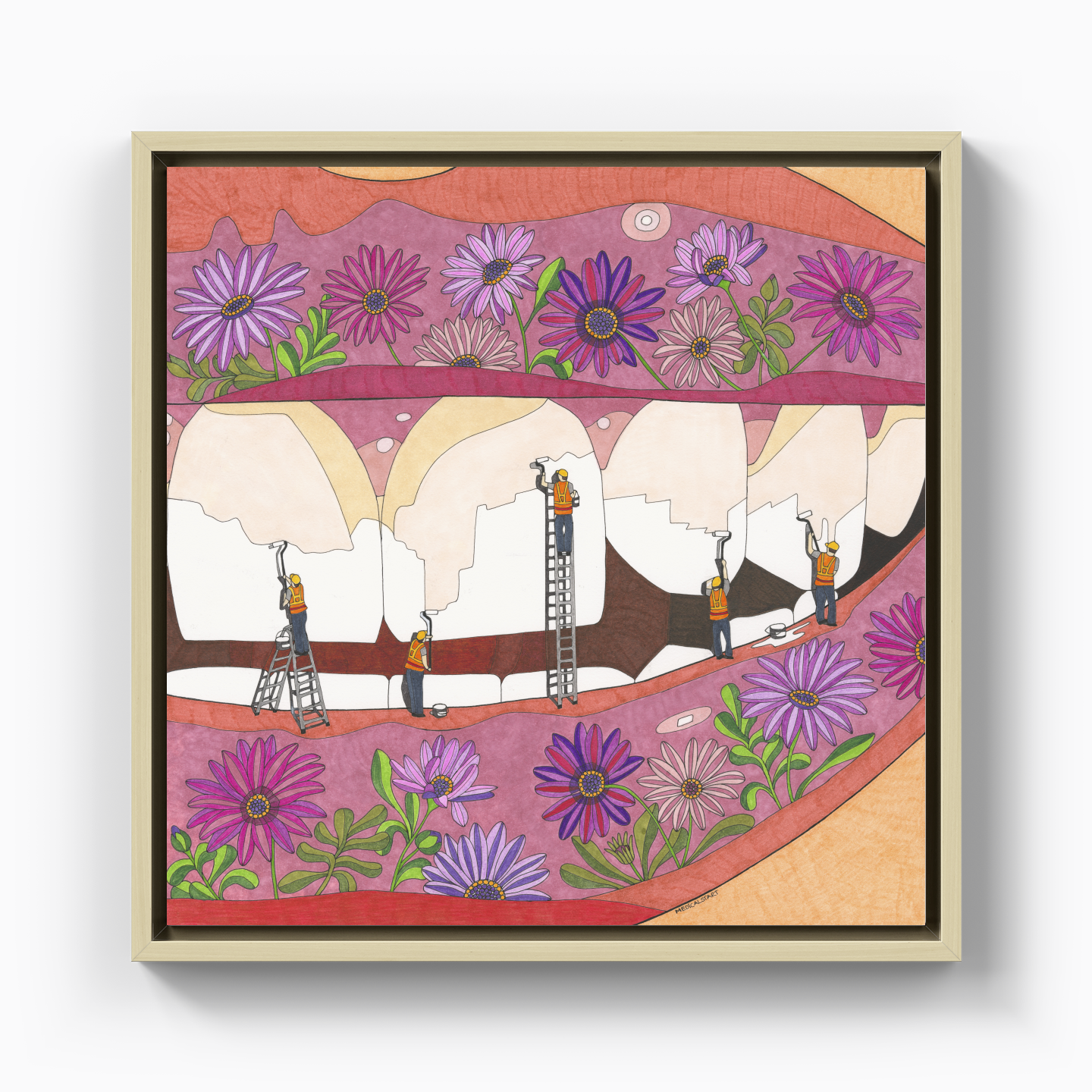 teeth whitening - Canvas Print