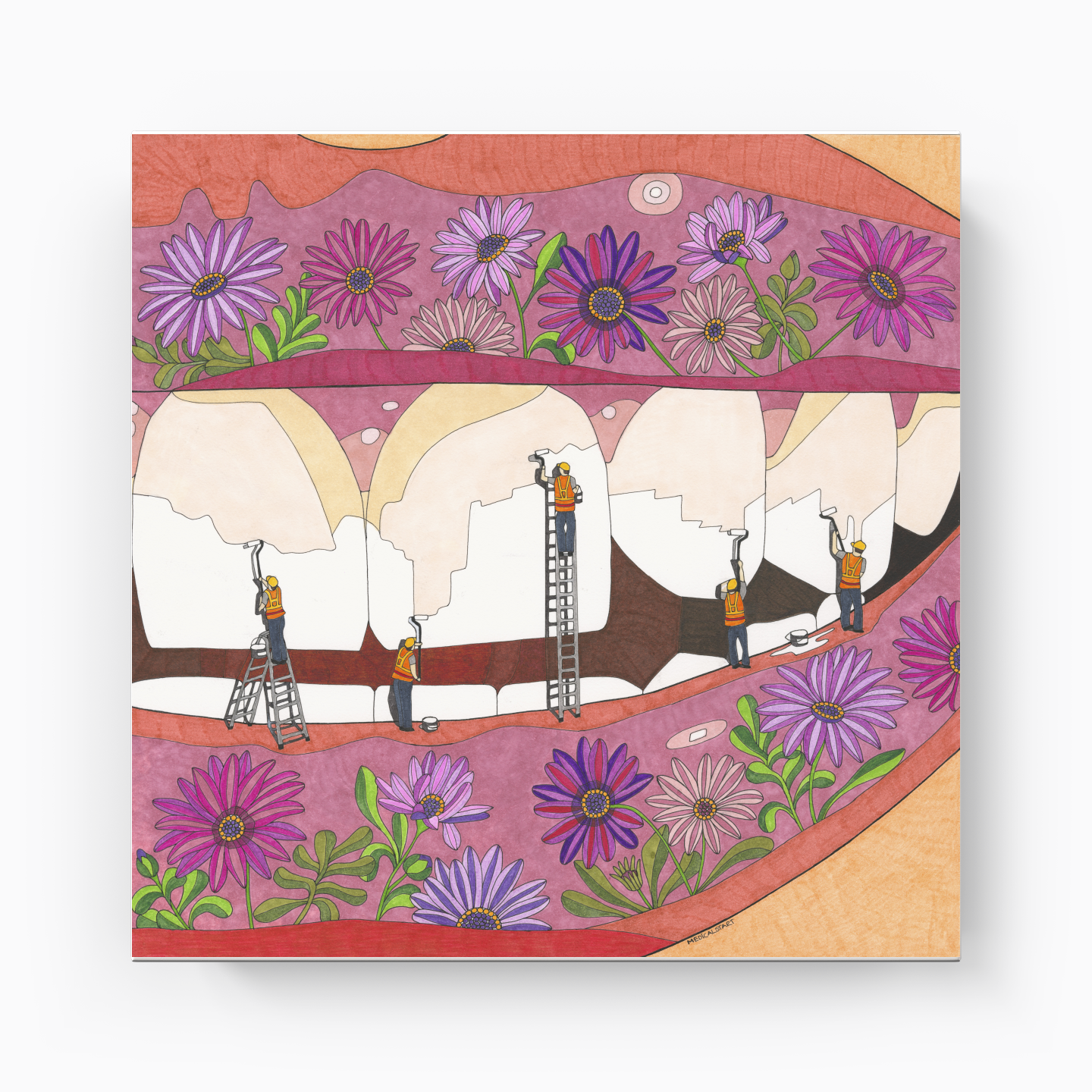 teeth whitening - Canvas Print