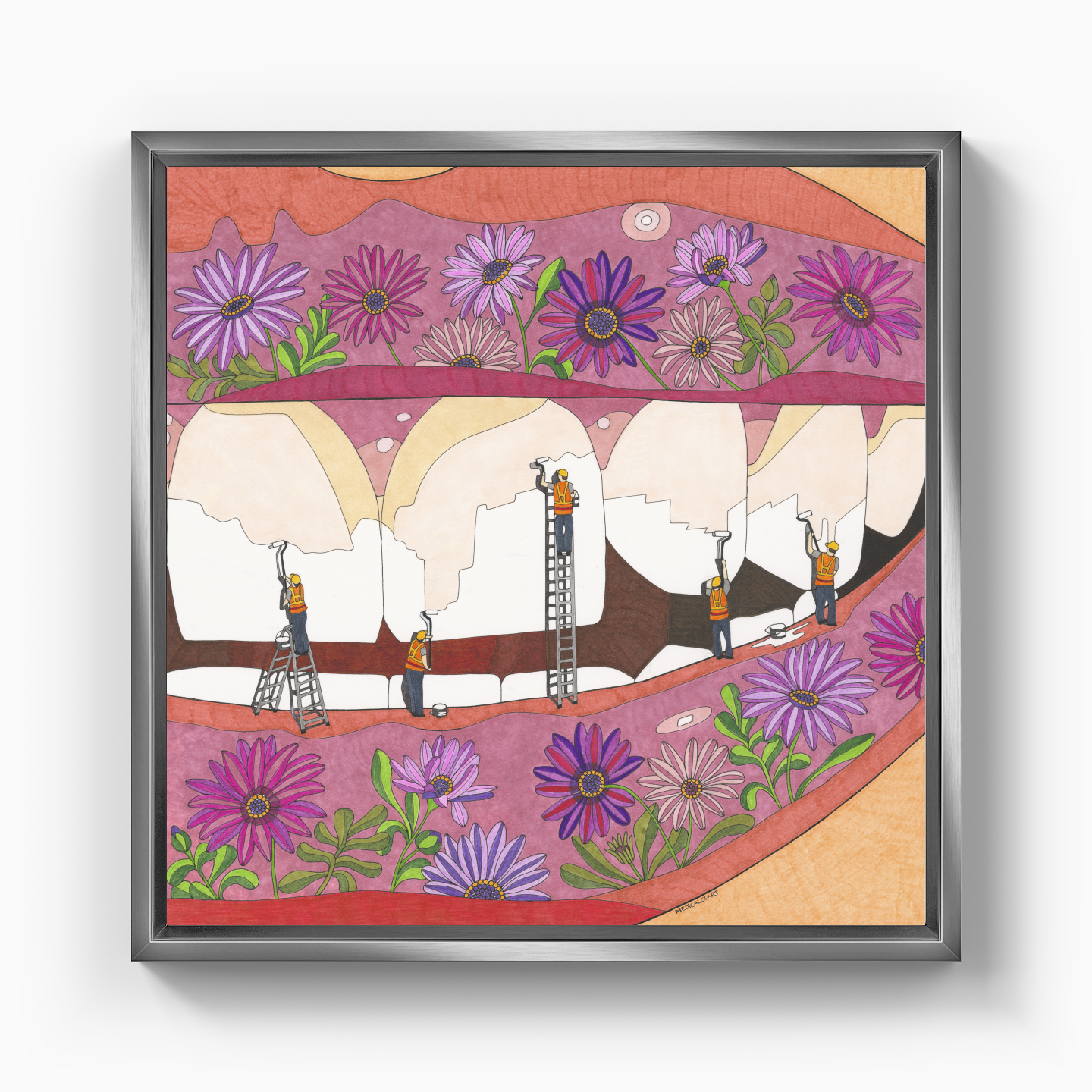 teeth whitening - Canvas Print