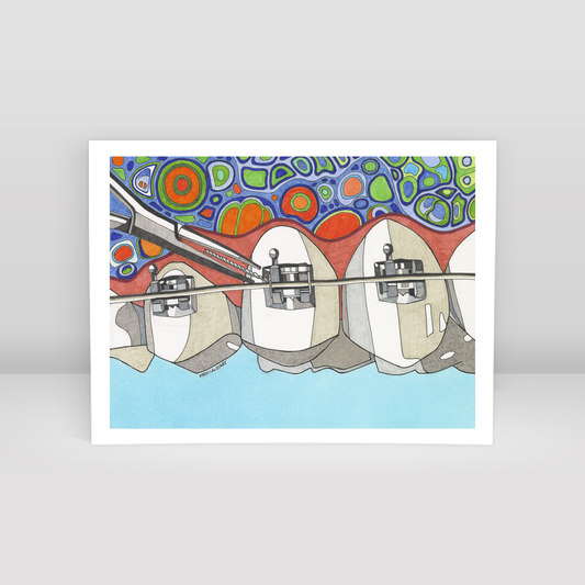 orthodontic treatment1 - Art Print