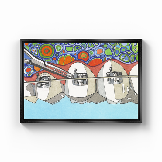 orthodontic treatment1 - Canvas Print