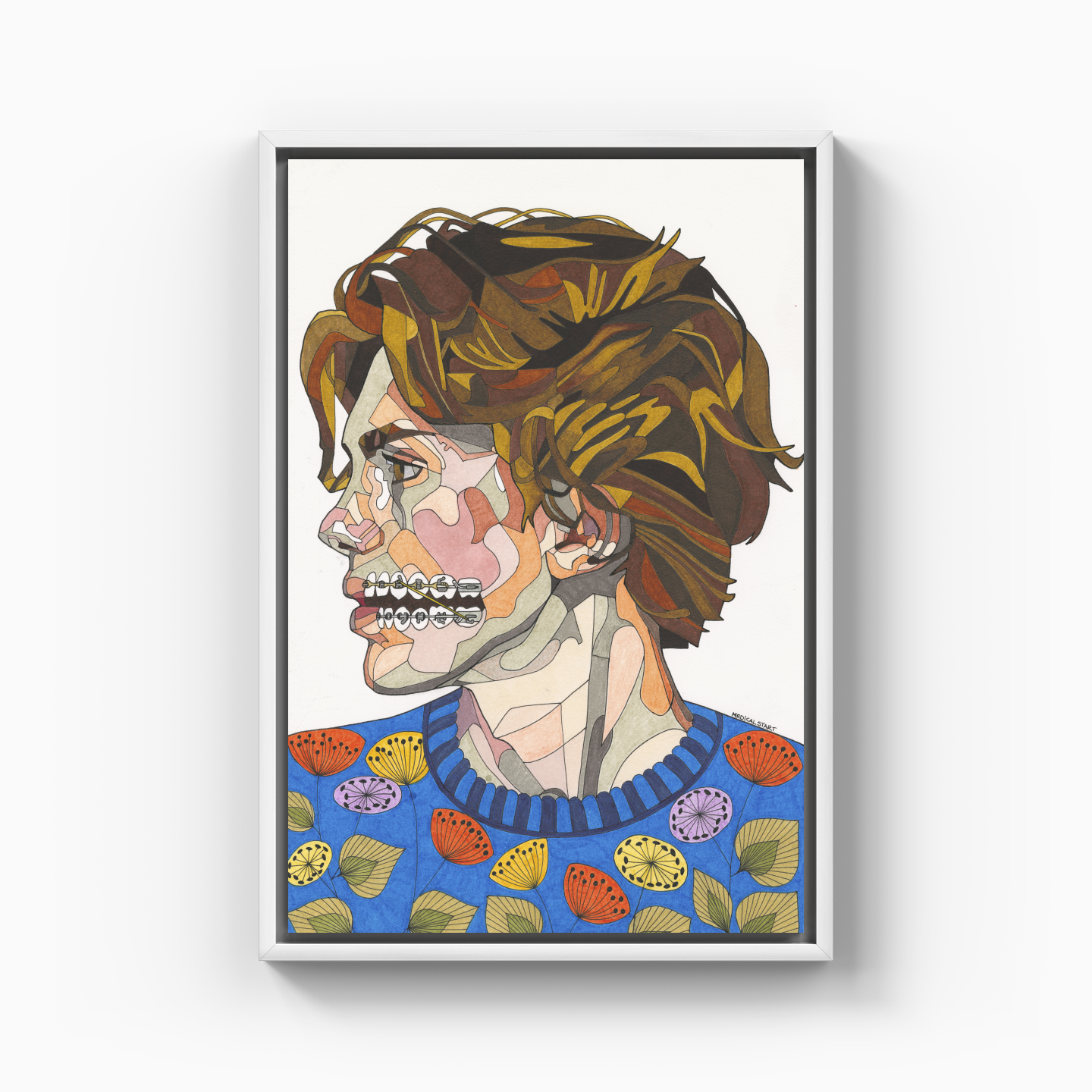 orthodontic treatment - Canvas Print