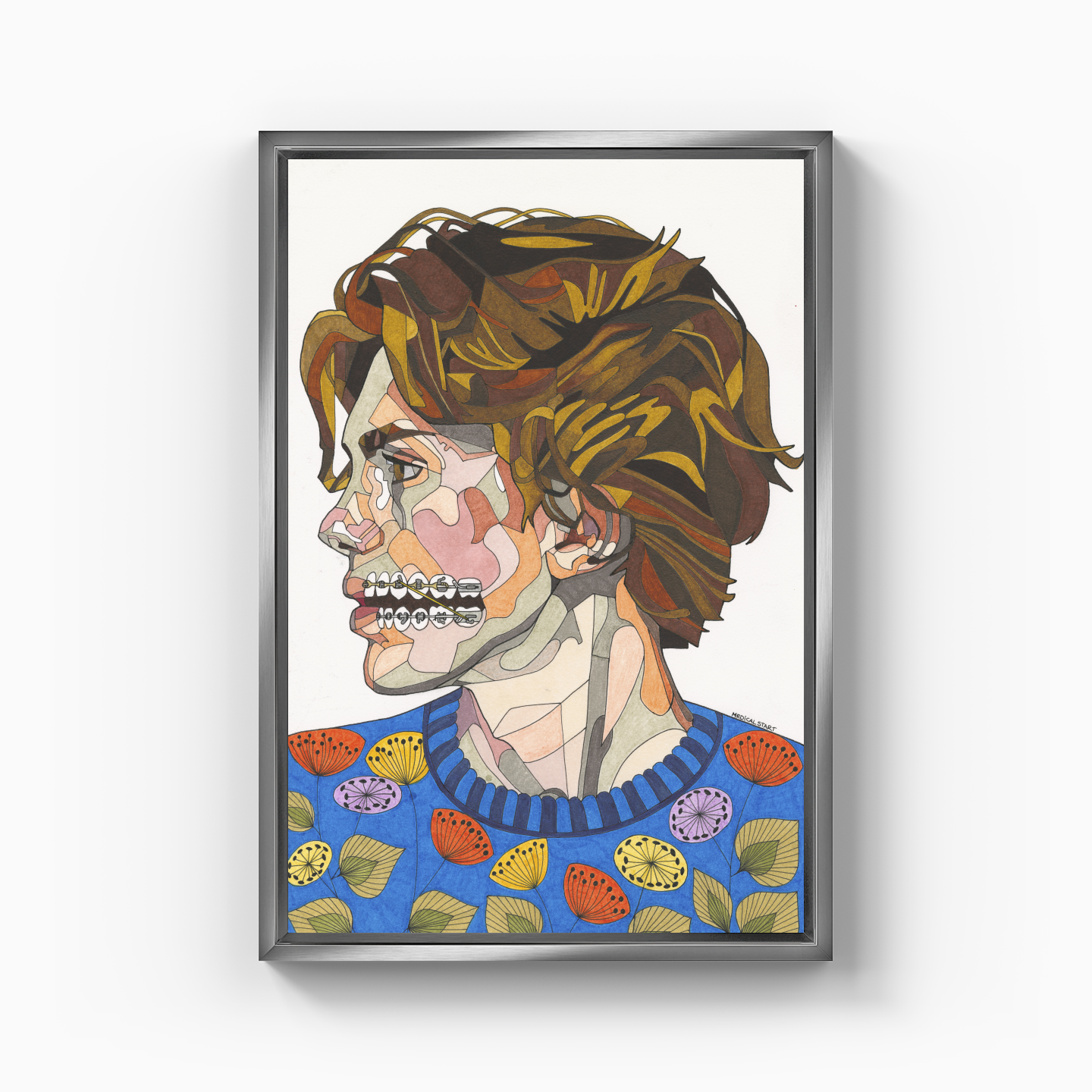 orthodontic treatment - Canvas Print