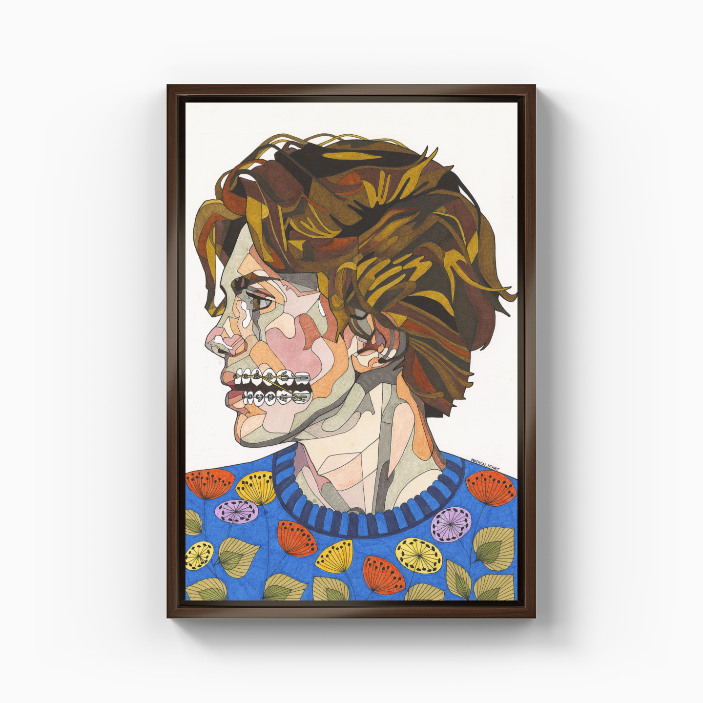 orthodontic treatment - Canvas Print