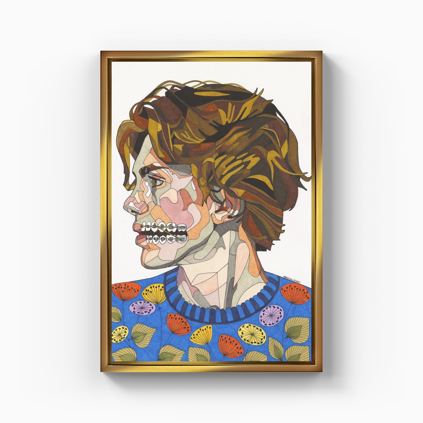 orthodontic treatment - Canvas Print