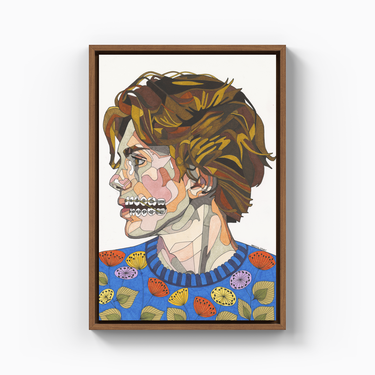 orthodontic treatment - Canvas Print