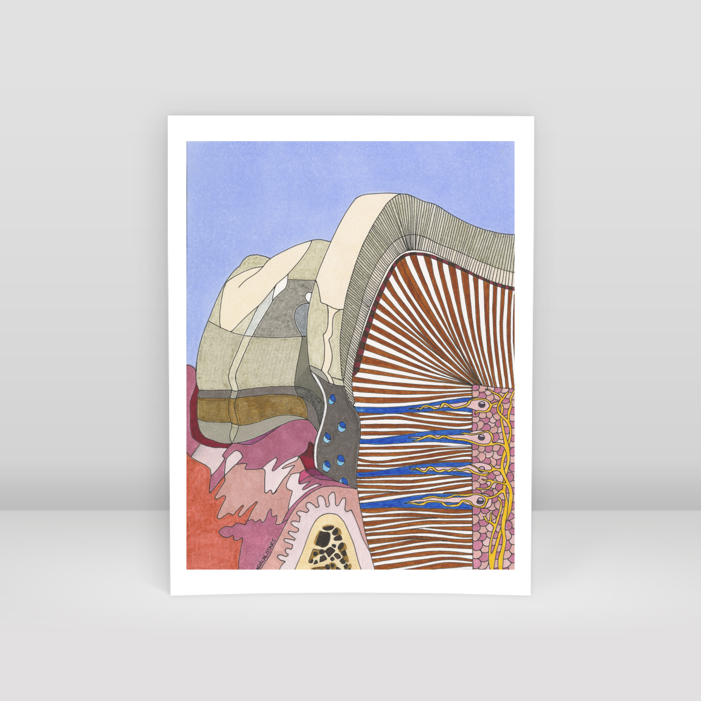 dental erosion - Art Print