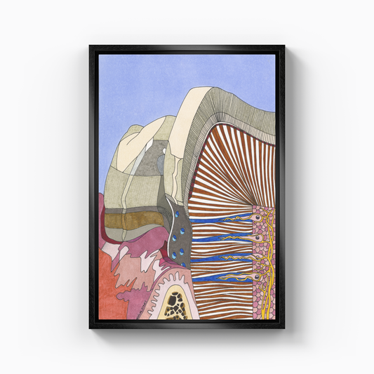 dental erosion - Canvas Print